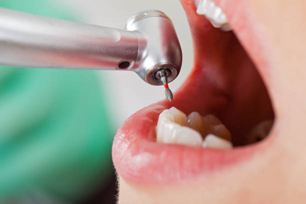 Best Emergency Dental Surgery in Tecumseh, OK